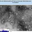 exosomes en microscopie électronique